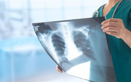 人工智能可以通过单次X光预测您10年内心脏病发作或中风的风险