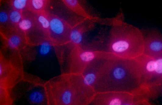 科学家解开了为什么OGT酶对细胞存活至关重要的谜团
