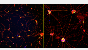 成熟的实验室培养神经元有望治疗神经退行性疾病