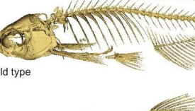 斑马鱼研究有助于揭示脊柱侧弯的起源