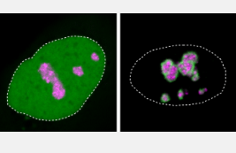 蛋白质飞沫可能导致多种类型的遗传疾病