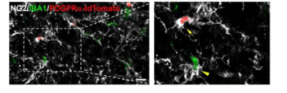 研究人员确定了神经退行性疾病中小胶质细胞增生的新细胞来源