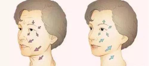 光子嫩肤是什么作用？ 光子嫩肤的功效