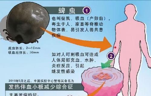 怎么消灭家里的蜱虫？ 屋内有蜱虫怎么去除