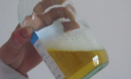 蛋白尿的症状有哪些？ 蛋白尿最明显的症状