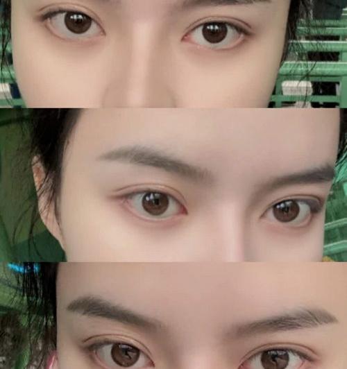 割双眼皮医院哪个好？ 全国割双眼皮最好的医院