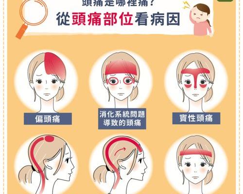头疼也分区域！8种「痛」预示着不同病因 头痛的位置代表的原因