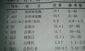 怎样看肝功能化验单？ 肝功能指标怎么看