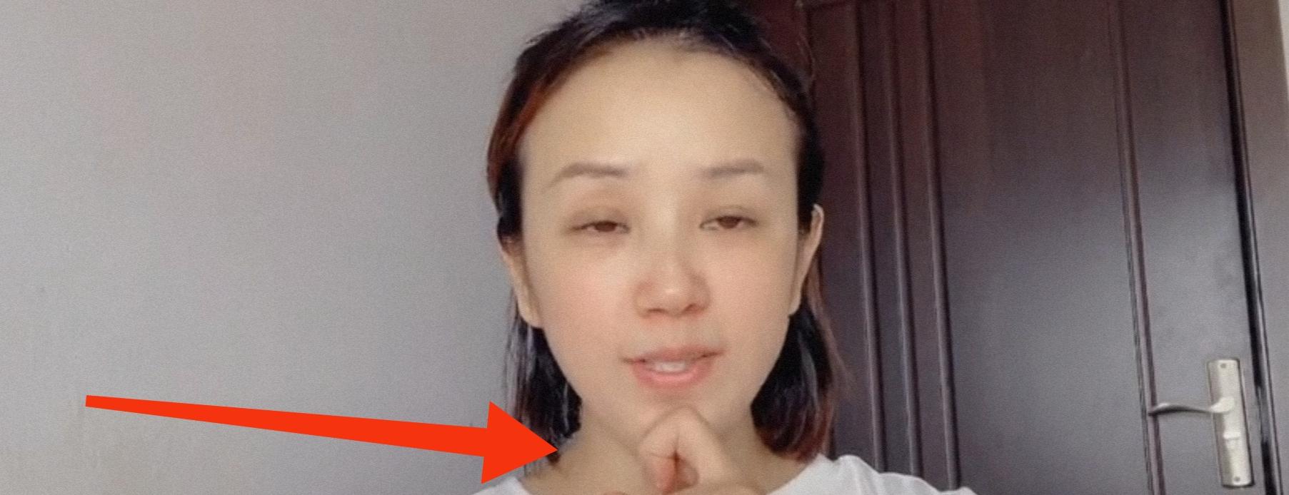 咬肌大怎么瘦下去？ 咬肌变大怎么消下来