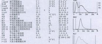 血常规化验单解读 血常规27项化验单解读