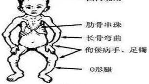 吕岩l和吕洞宾是同一人吗 ,理由是。 佝偻病真人