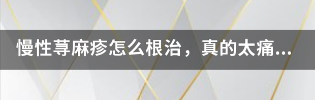 慢性荨麻疹，怎样才能痊愈？ 慢性荨麻疹怎么治
