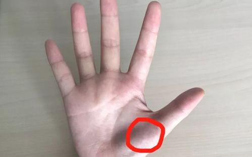 腱鞘炎偏方_治疗腱鞘炎的偏方 腱鞘炎的老偏方