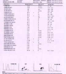 双肾结石吃什么药最好什么药排石效果比较好啊？ 肾结石吃什么药能排石