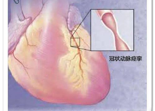 心肌缺血怎么办吃什么食物比较好？ 心肌严重缺血吃什么补得快