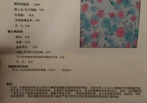 hpv33,hpv阳性是什么意？ hpv阳性是什么意思