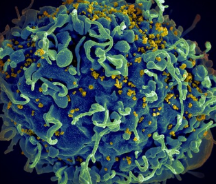 研究人员发现HIV侵入细胞核的新途径